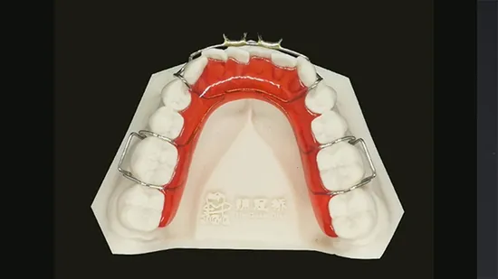 Improved Dental Orthodontic Hawley Retainer with Printed Resin Model Denture Teeth False Teeth Lab China 