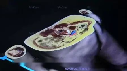 Medical 3D Human Anatomy Virtual System 