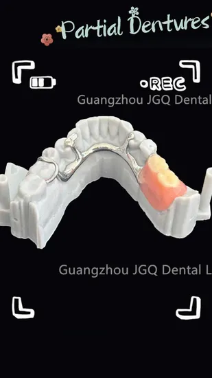 Free Models Printed Lab Cheap Price Metal Framework Dentures and Pfm Crowns with Ball