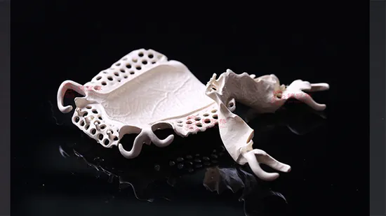 for Dental Clinic for Dentist Dental Laboratory Denture Attachment 3D Peek Printed Partial Removable Denture Non