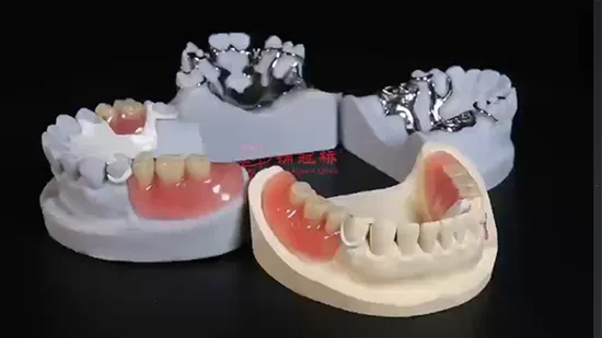 Complete Denture Dental Laboratory CAD/Cam Customized 3D Metal Printed Partial Removable Denture 