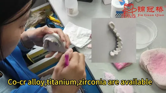 Dental Lab Artificial Tooth Fixed Denture Pfm 3D Metal Printed Porcelain False Teeth Aesthetics and Cheap 