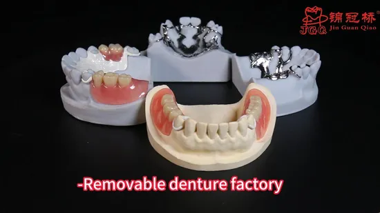 Custom Milled Metal Framework Titanium Frame 3D Printed with Removable Dentures 
