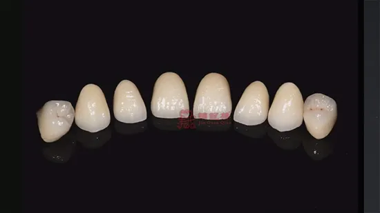 3D Printed Digital Dental Lab Supply Full Zirconia All Ceramic Denture Restoration 